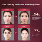LED Photon Therapy Facial Lifting Massager-4
