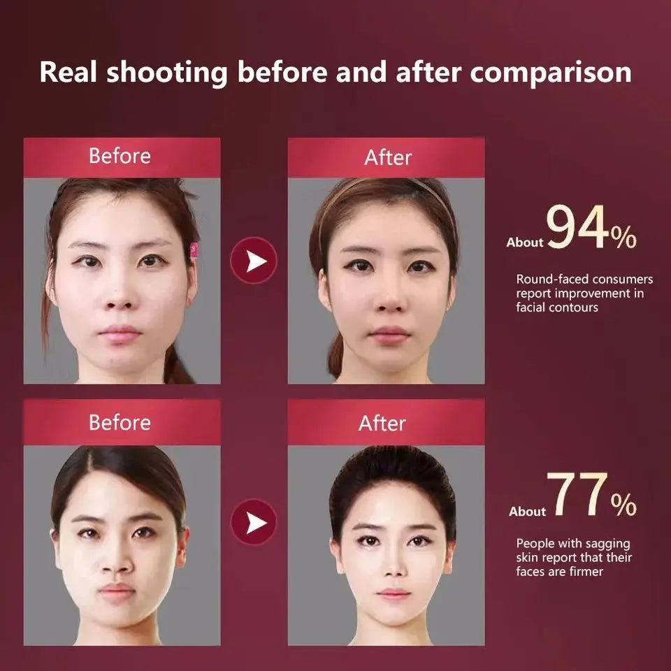 LED Photon Therapy Facial Lifting Massager-4